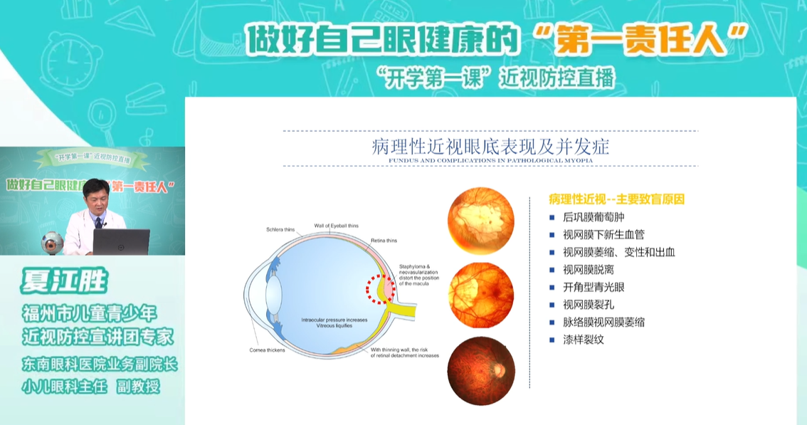 福州科技館眼健康分館開展做好自己眼健康的“第一責(zé)任人”開學(xué)第一課近視防控直播